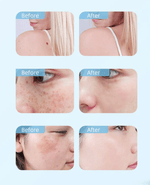 Load image into Gallery viewer, 4 Wand, High Frequency Ozone Skin Therapy

