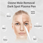 Load image into Gallery viewer, 4 Wand, High Frequency Ozone Skin Therapy

