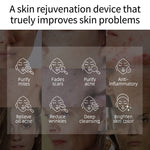 Load image into Gallery viewer, Plasma Skin Care Facial Rejuvenator Massager

