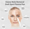 4 Wand, High Frequency Ozone Skin Therapy